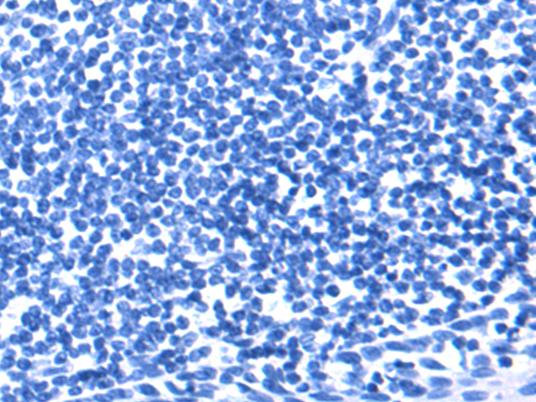 Donkey Anti-Goat IgG antibody (HRP). GTX232040-01