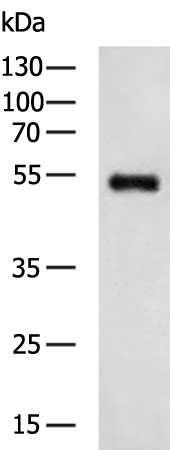 Donkey Anti-Goat IgG antibody (HRP). GTX232040-01