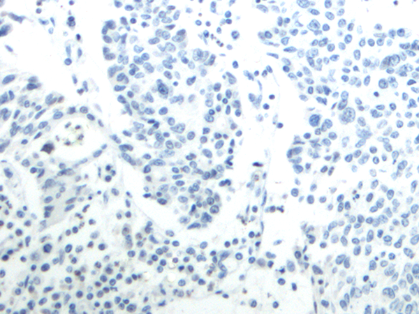 Donkey Anti-Goat IgG antibody (HRP). GTX232040-01