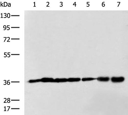 Donkey Anti-Goat IgG antibody (HRP). GTX232040-01