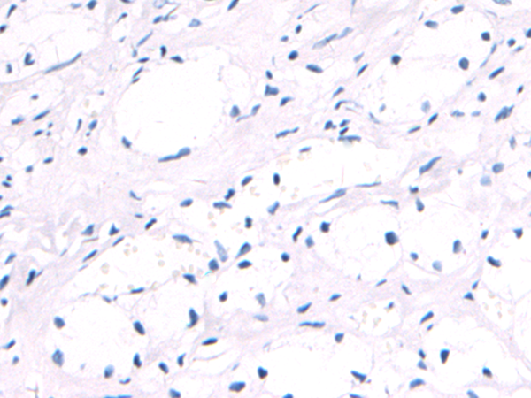 Donkey Anti-Goat IgG antibody (HRP). GTX232040-01