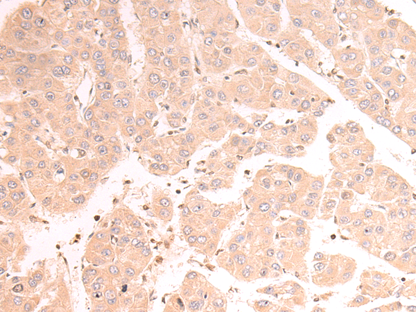 Donkey Anti-Goat IgG antibody (HRP). GTX232040-01