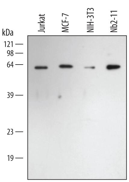 Donkey Anti-Goat IgG antibody (HRP). GTX232040-01