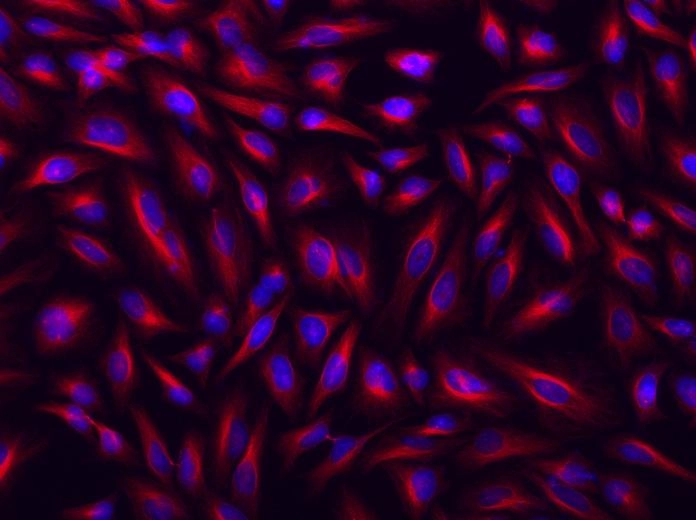 Donkey Anti-Goat IgG antibody (HRP). GTX232040-01
