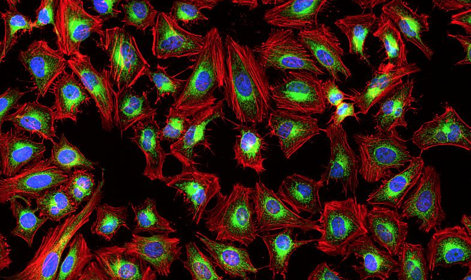 Donkey Anti-Goat IgG antibody (HRP). GTX232040-01