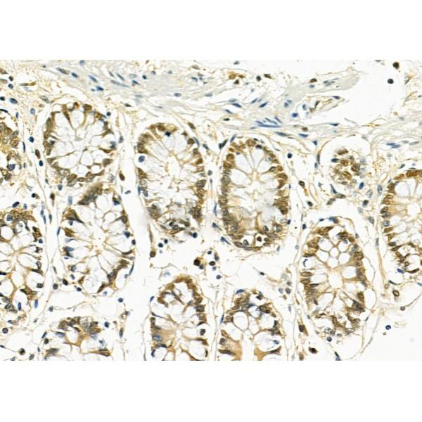 Donkey Anti-Goat IgG antibody (HRP). GTX232040-01