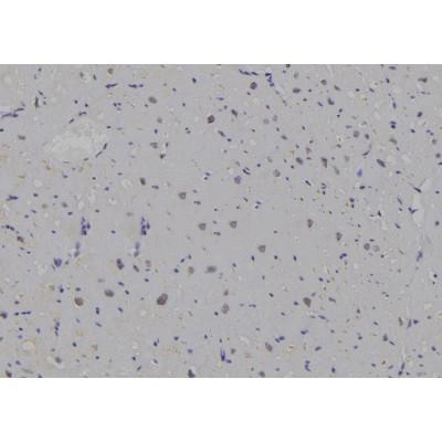 Donkey Anti-Goat IgG antibody (HRP). GTX232040-01