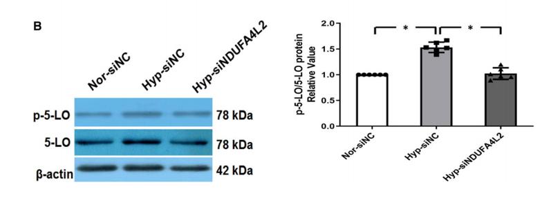 Donkey Anti-Goat IgG antibody (HRP). GTX232040-01