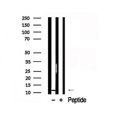 Donkey Anti-Goat IgG antibody (HRP). GTX232040-01