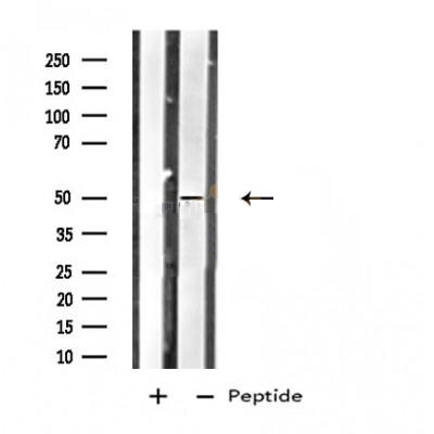 Donkey Anti-Goat IgG antibody (HRP). GTX232040-01