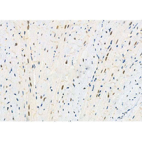 Donkey Anti-Goat IgG antibody (HRP). GTX232040-01