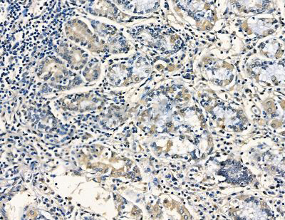 Donkey Anti-Goat IgG antibody (HRP). GTX232040-01