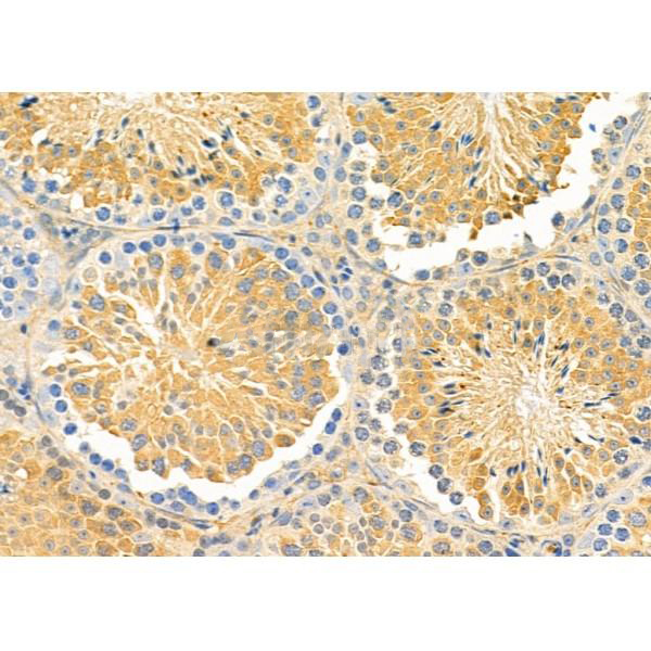 Donkey Anti-Goat IgG antibody (HRP). GTX232040-01
