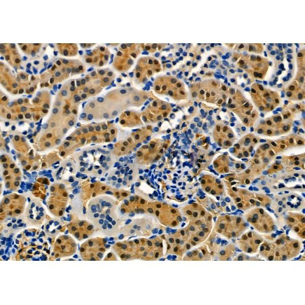 Donkey Anti-Goat IgG antibody (HRP). GTX232040-01