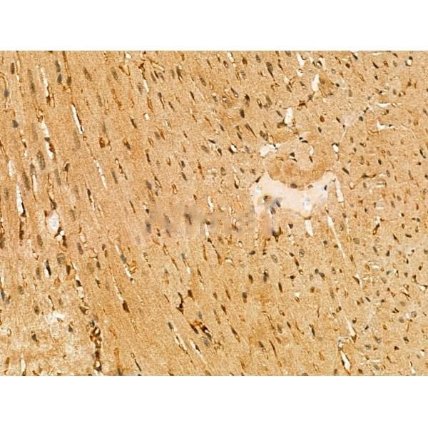 Donkey Anti-Goat IgG antibody (HRP). GTX232040-01