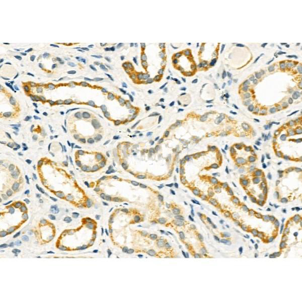 Donkey Anti-Goat IgG antibody (HRP). GTX232040-01