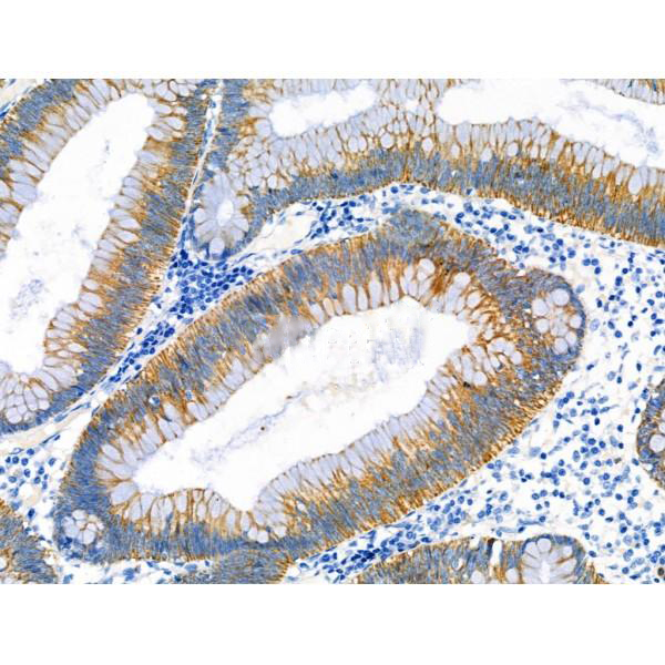 Donkey Anti-Goat IgG antibody (HRP). GTX232040-01