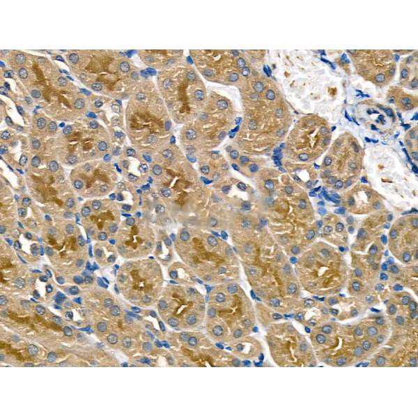 Donkey Anti-Goat IgG antibody (HRP). GTX232040-01