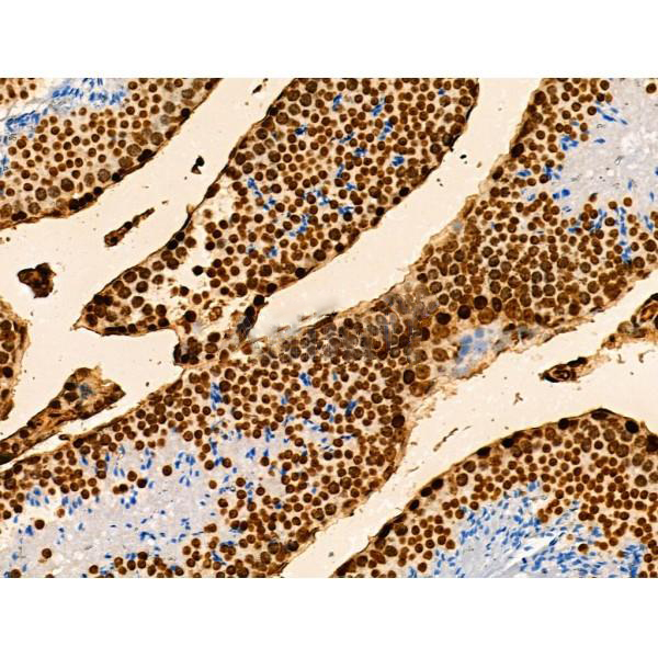 Donkey Anti-Goat IgG antibody (HRP). GTX232040-01