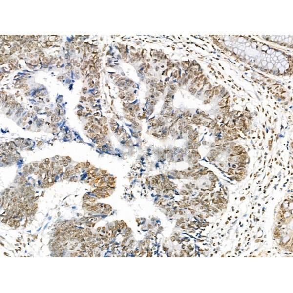 Donkey Anti-Goat IgG antibody (HRP). GTX232040-01