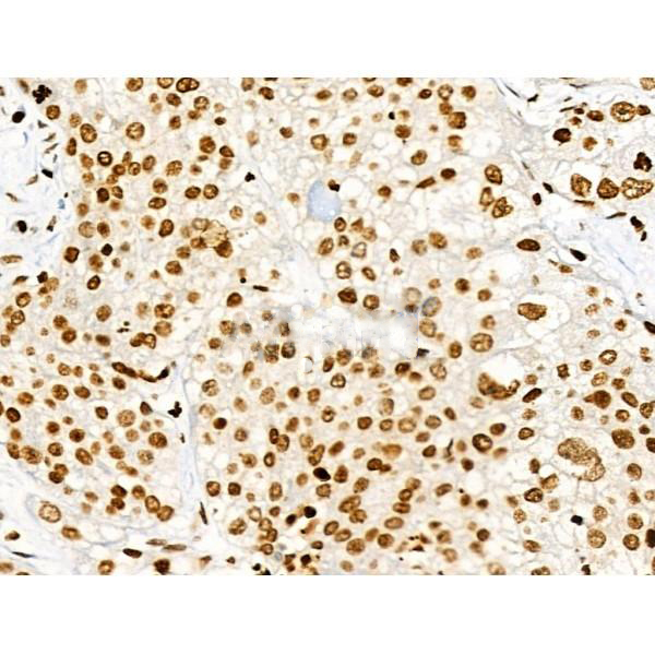 Donkey Anti-Goat IgG antibody (HRP). GTX232040-01