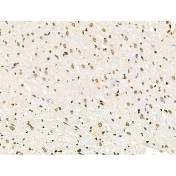 Donkey Anti-Goat IgG antibody (HRP). GTX232040-01