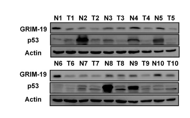 Donkey Anti-Goat IgG antibody (HRP). GTX232040-01
