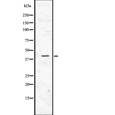 Donkey Anti-Goat IgG antibody (HRP). GTX232040-01