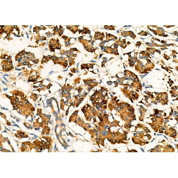 Donkey Anti-Goat IgG antibody (HRP). GTX232040-01