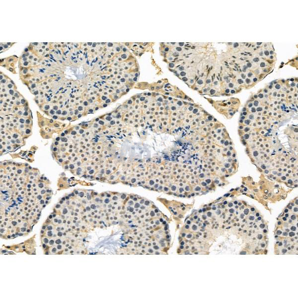 Donkey Anti-Goat IgG antibody (HRP). GTX232040-01