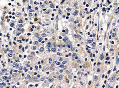 Donkey Anti-Goat IgG antibody (HRP). GTX232040-01