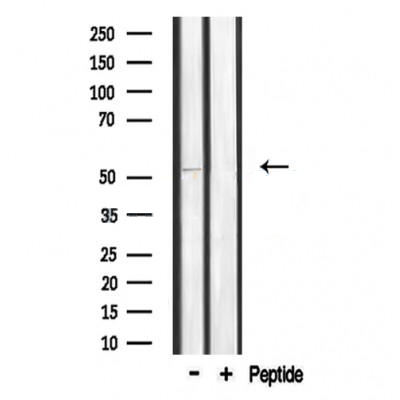 Donkey Anti-Goat IgG antibody (HRP). GTX232040-01