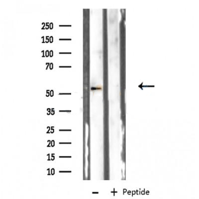 Donkey Anti-Goat IgG antibody (HRP). GTX232040-01