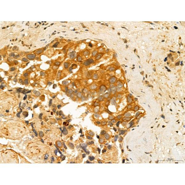 Donkey Anti-Goat IgG antibody (HRP). GTX232040-01