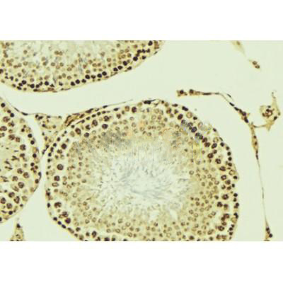 Donkey Anti-Goat IgG antibody (HRP). GTX232040-01