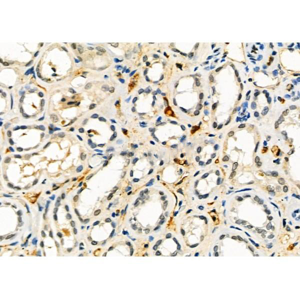 Donkey Anti-Goat IgG antibody (HRP). GTX232040-01