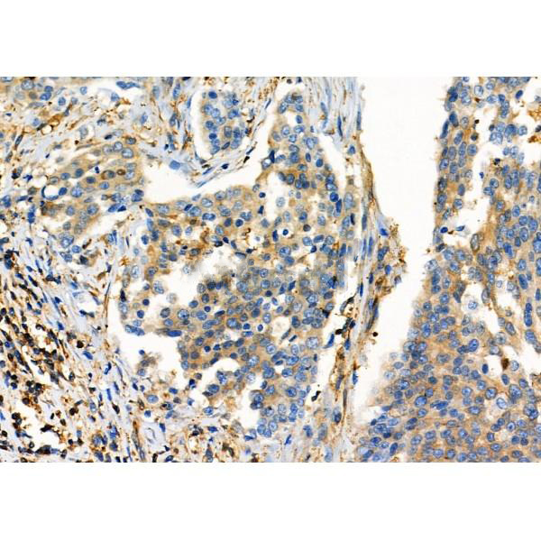 Donkey Anti-Goat IgG antibody (HRP). GTX232040-01