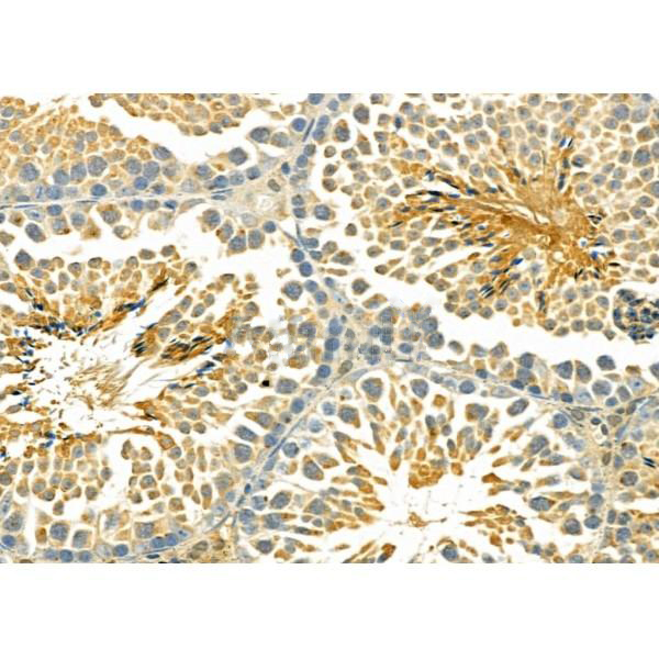 Donkey Anti-Goat IgG antibody (HRP). GTX232040-01