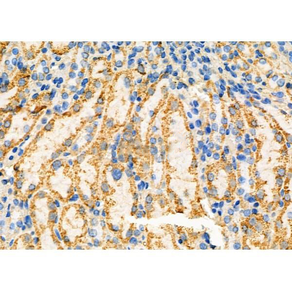 Donkey Anti-Goat IgG antibody (HRP). GTX232040-01