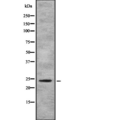 Donkey Anti-Goat IgG antibody (HRP). GTX232040-01