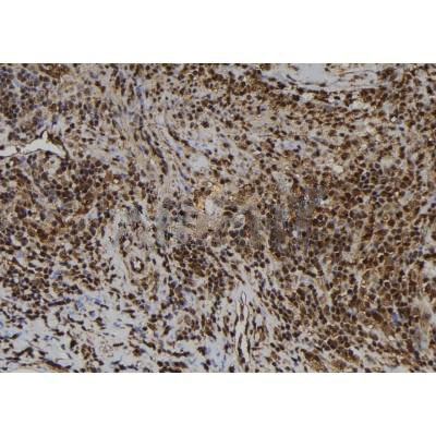 Donkey Anti-Goat IgG antibody (HRP). GTX232040-01