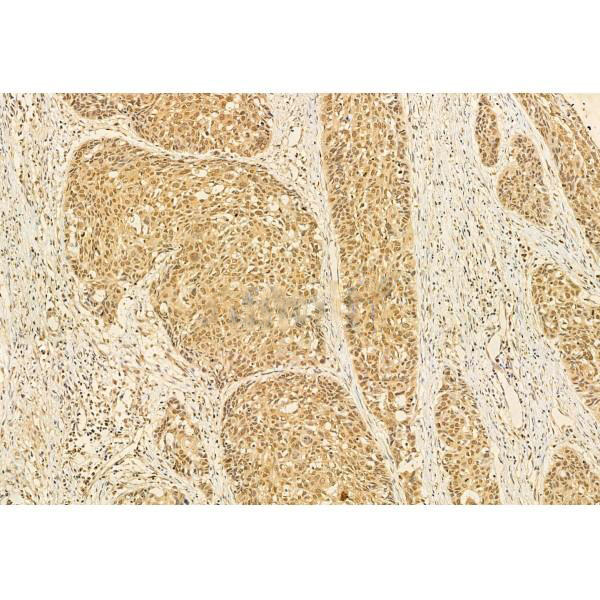 Donkey Anti-Goat IgG antibody (HRP). GTX232040-01