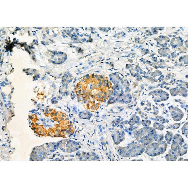 Donkey Anti-Goat IgG antibody (HRP). GTX232040-01