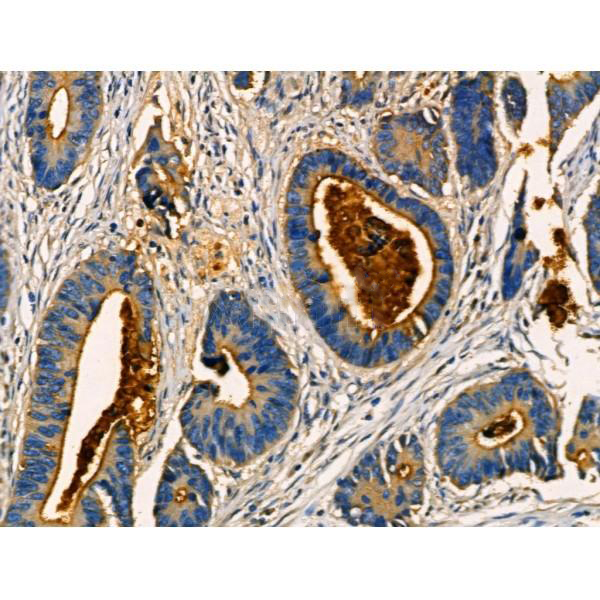 Donkey Anti-Goat IgG antibody (HRP). GTX232040-01