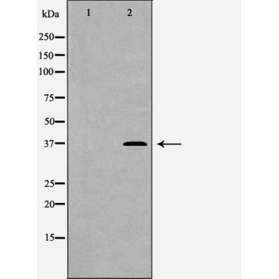 Donkey Anti-Goat IgG antibody (HRP). GTX232040-01
