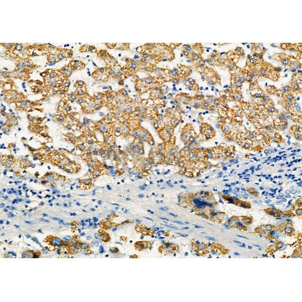 Donkey Anti-Goat IgG antibody (HRP). GTX232040-01