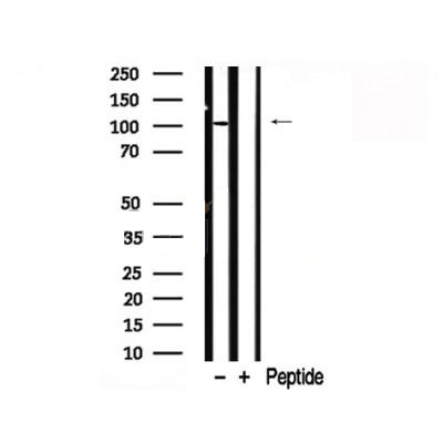 Donkey Anti-Goat IgG antibody (HRP). GTX232040-01