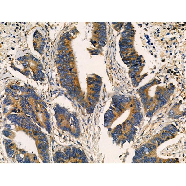 Donkey Anti-Goat IgG antibody (HRP). GTX232040-01