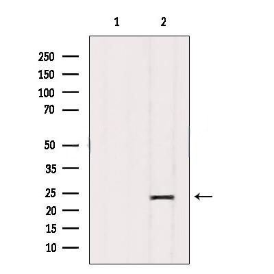 Donkey Anti-Goat IgG antibody (HRP). GTX232040-01