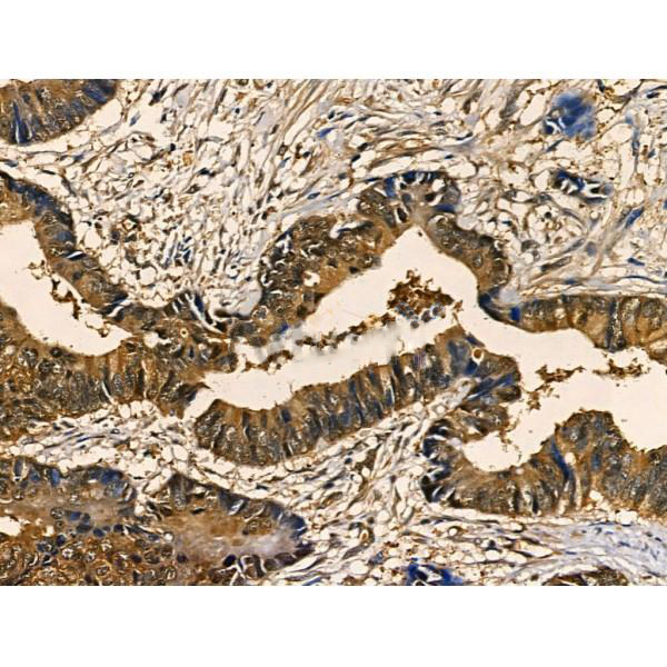 Donkey Anti-Goat IgG antibody (HRP). GTX232040-01